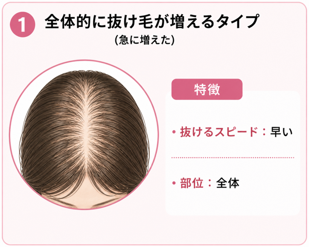 女性の薄毛 全体的に抜け毛が増えるタイプ