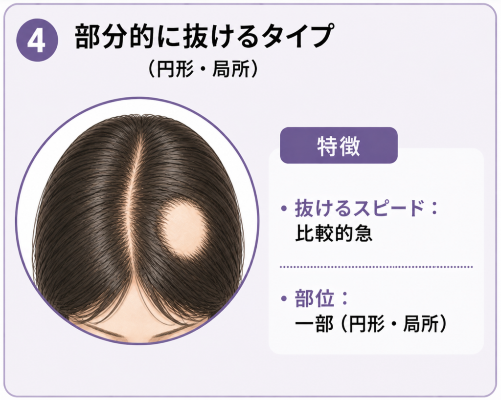 女性の薄毛 部分的に抜けるタイプ