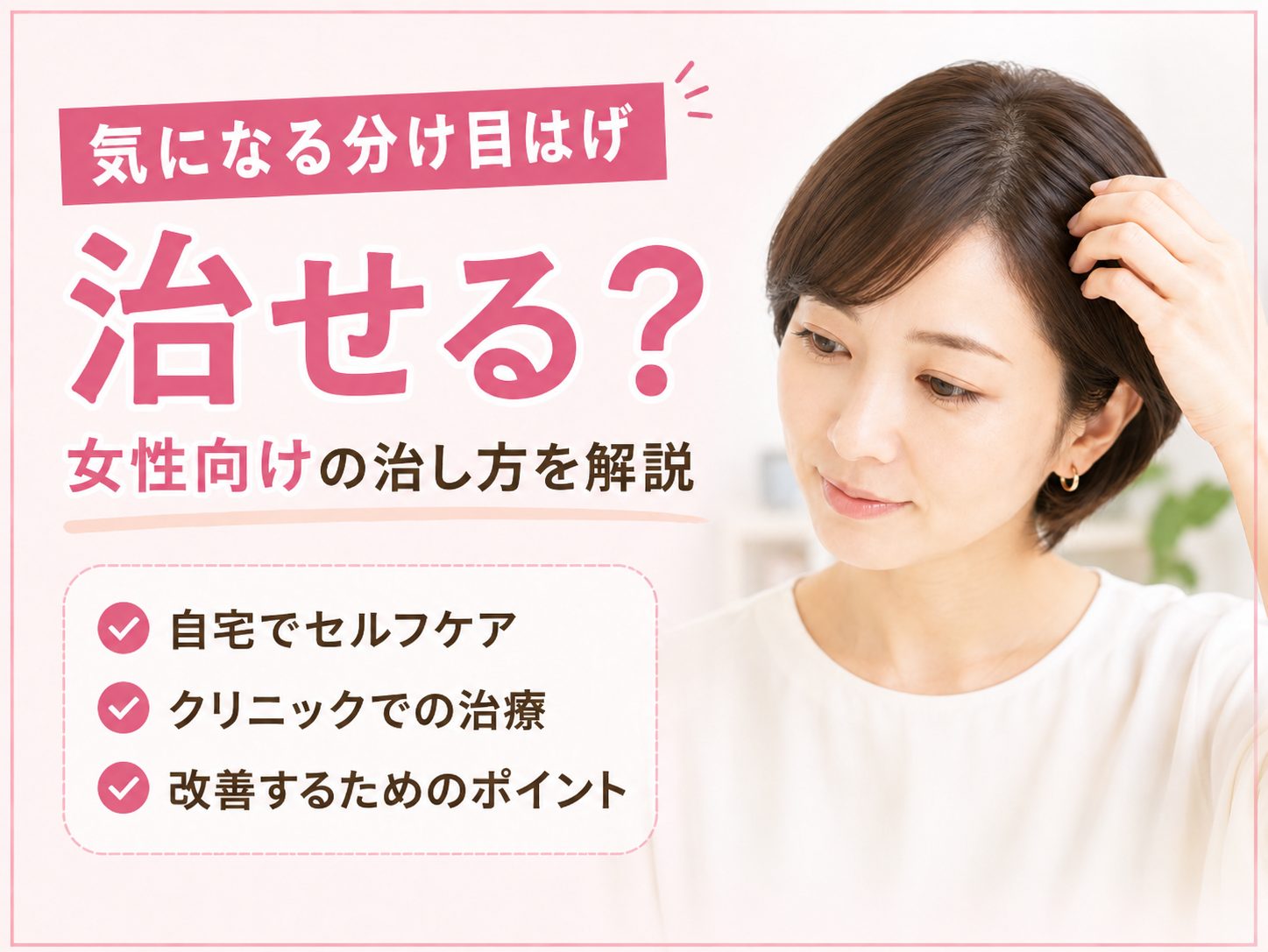 分け目はげ 女性 治す